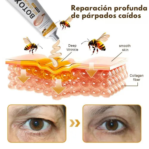 Lifting de Veneno de Abeja: El secreto natural para tensar tu piel sin agujas