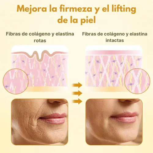 Lifting de Veneno de Abeja: El secreto natural para tensar tu piel sin agujas
