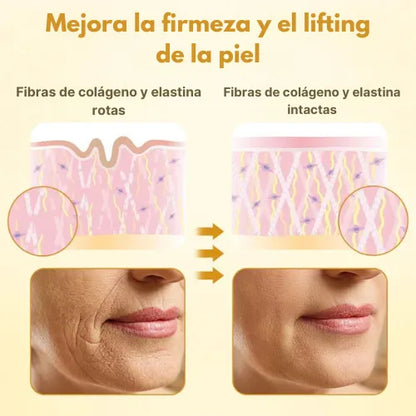 Lifting de Veneno de Abeja: El secreto natural para tensar tu piel sin agujas